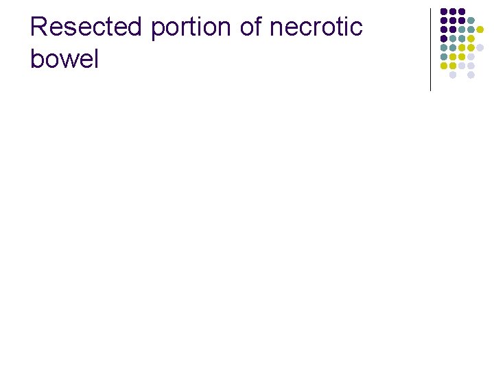 Resected portion of necrotic bowel 