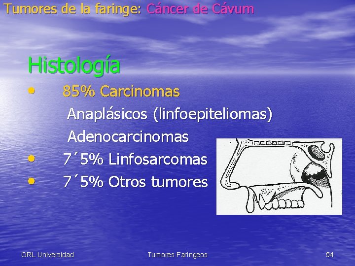 Tumores de la faringe: Cáncer de Cávum Histología • • • 85% Carcinomas Anaplásicos