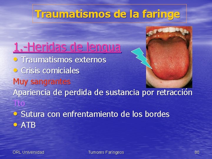 Traumatismos de la faringe 1. -Heridas de lengua • Traumatismos externos • Crisis comiciales