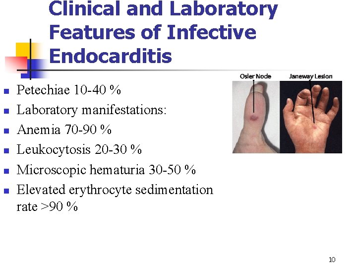 Clinical and Laboratory Features of Infective Endocarditis n n n Petechiae 10 -40 %