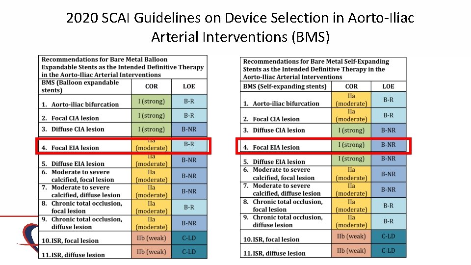 2020 SCAI Guidelines on Device Selection in Aorto-Iliac Arterial Interventions (BMS) 