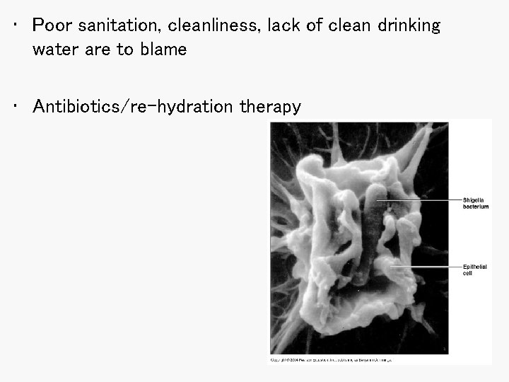 • Poor sanitation, cleanliness, lack of clean drinking water are to blame •
