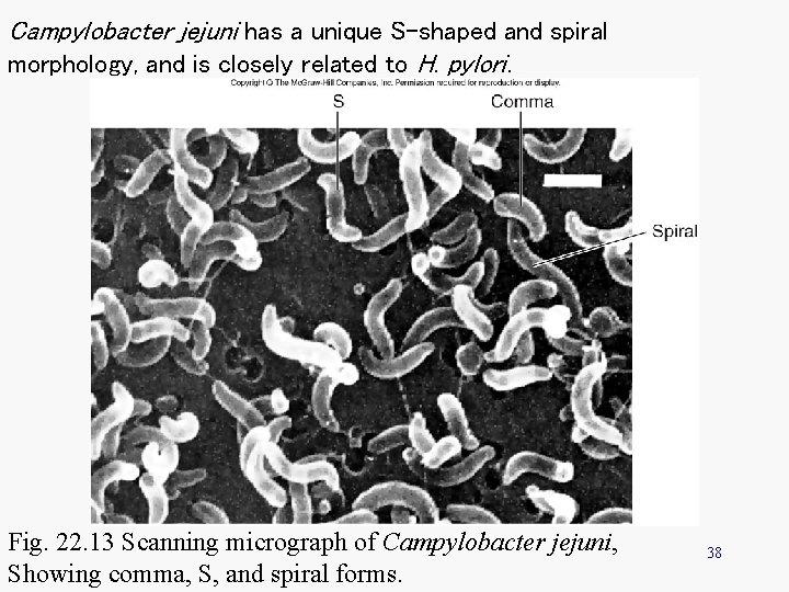 Campylobacter jejuni has a unique S-shaped and spiral morphology, and is closely related to