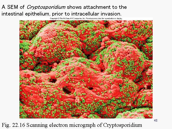 A SEM of Cryptosporidium shows attachment to the intestinal epithelium, prior to intracellular invasion.