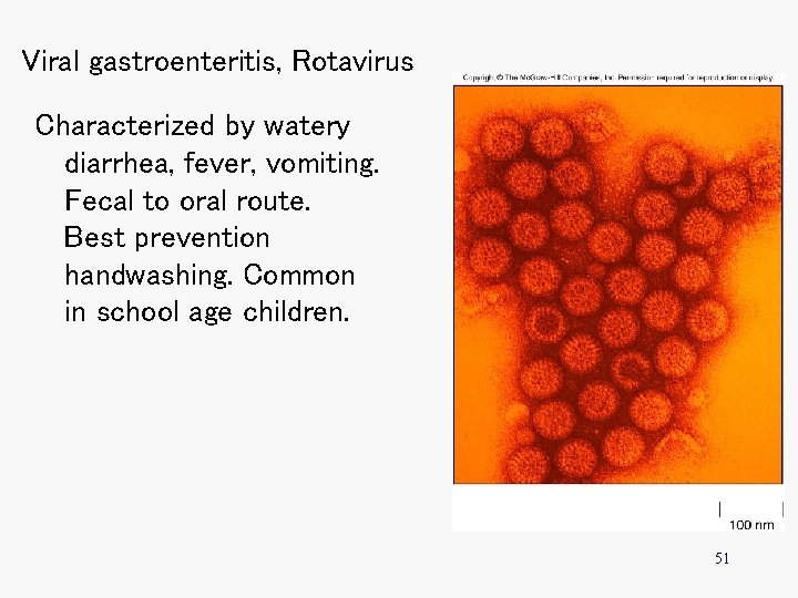 Viral gastroenteritis, Rotavirus Characterized by watery diarrhea, fever, vomiting. Fecal to oral route. Best