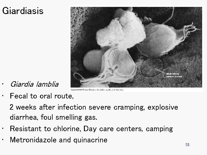 Giardiasis • Giardia lamblia • Fecal to oral route, 2 weeks after infection severe