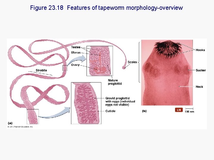 Figure 23. 18 Features of tapeworm morphology-overview 
