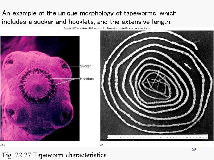 An example of the unique morphology of tapeworms, which includes a sucker and hooklets,