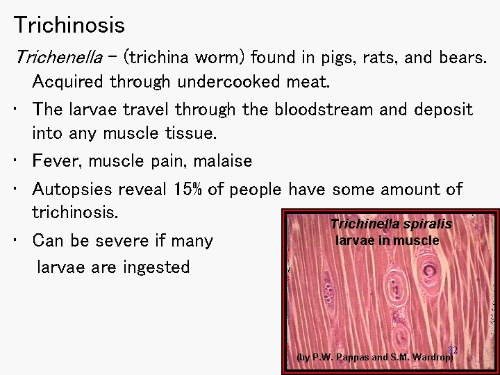 Trichinosis Trichenella – (trichina worm) found in pigs, rats, and bears. • • Acquired