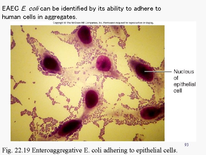 EAEC E. coli can be identified by its ability to adhere to human cells