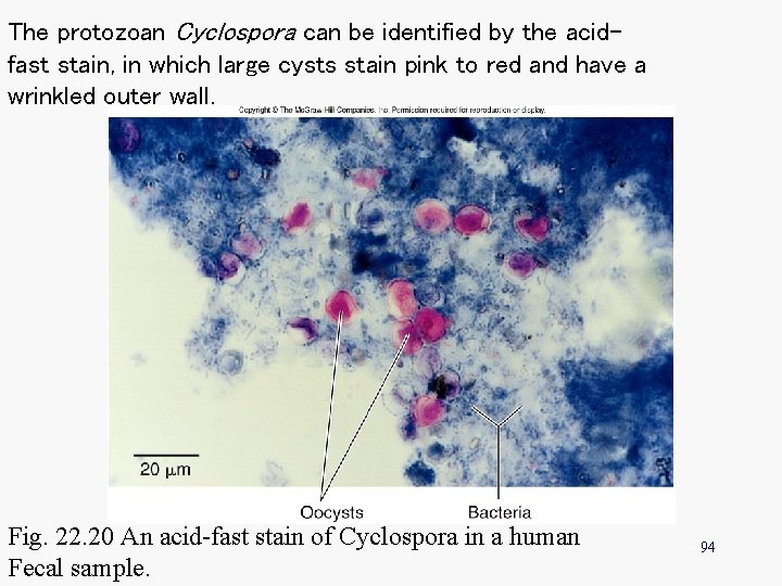 The protozoan Cyclospora can be identified by the acidfast stain, in which large cysts