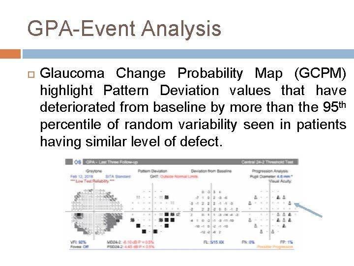 GPA-Event Analysis Glaucoma Change Probability Map (GCPM) highlight Pattern Deviation values that have deteriorated