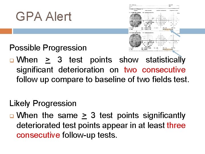 GPA Alert Possible Progression q When > 3 test points show statistically significant deterioration