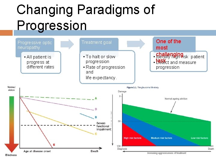 Changing Paradigms of Progression Progressive optic neuropathy • All patient is progress at different