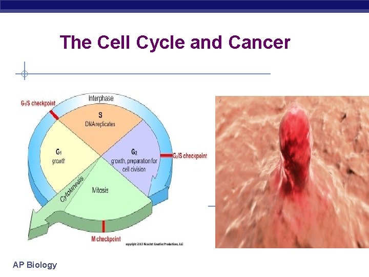 The Cell Cycle and Cancer AP Biology 