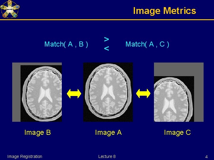 Image Metrics Match( A , B ) Image B Image Registration > < Image