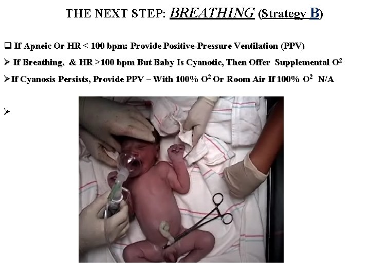 THE NEXT STEP: BREATHING (Strategy B) q If Apneic Or HR < 100 bpm: