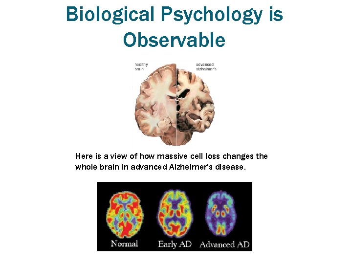 Biological Psychology is Observable Here is a view of how massive cell loss changes