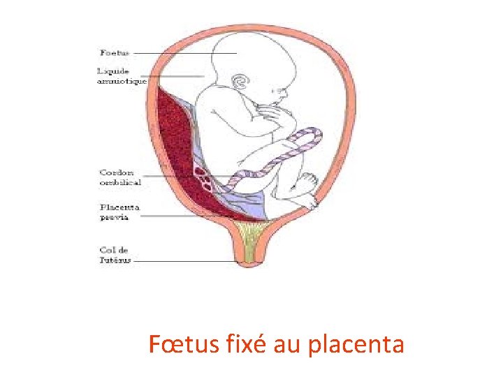 Fœtus fixé au placenta 