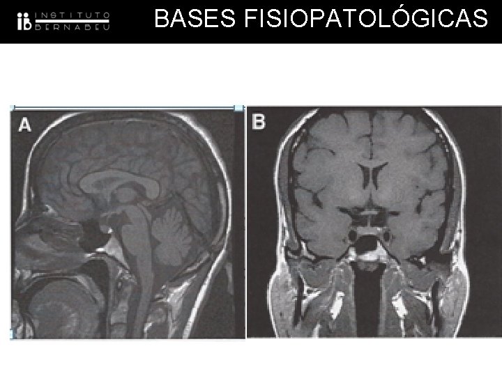 BASES FISIOPATOLÓGICAS 