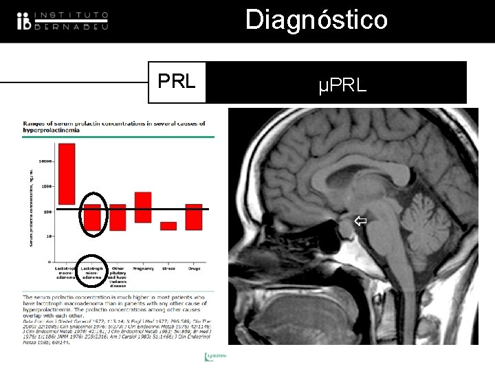 Diagnóstico PRL µPRL 