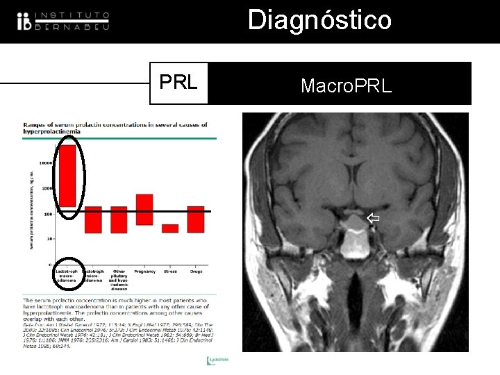 Diagnóstico PRL Macro. PRL 