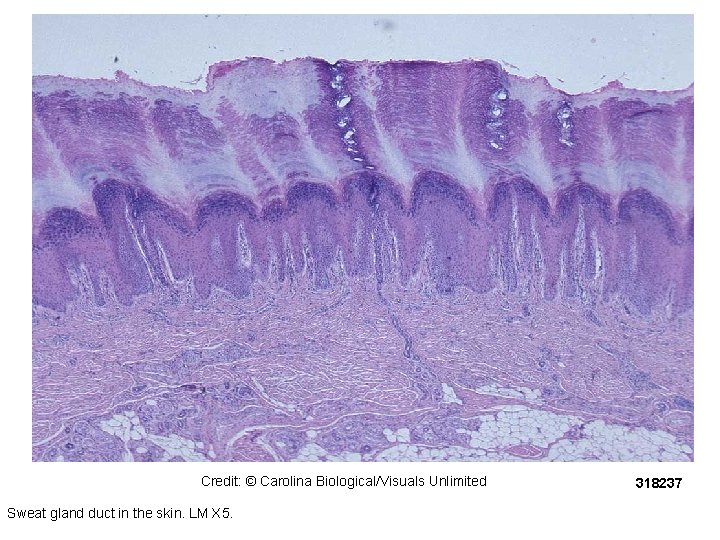 Credit: © Carolina Biological/Visuals Unlimited Sweat gland duct in the skin. LM X 5. Credit: © Carolina Biological/Visuals Unlimited Sweat gland duct in the skin. LM X 5.