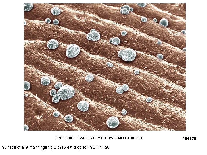 Credit: © Dr. Wolf Fahrenbach/Visuals Unlimited Surface of a human fingertip with sweat droplets. Credit: © Dr. Wolf Fahrenbach/Visuals Unlimited Surface of a human fingertip with sweat droplets.