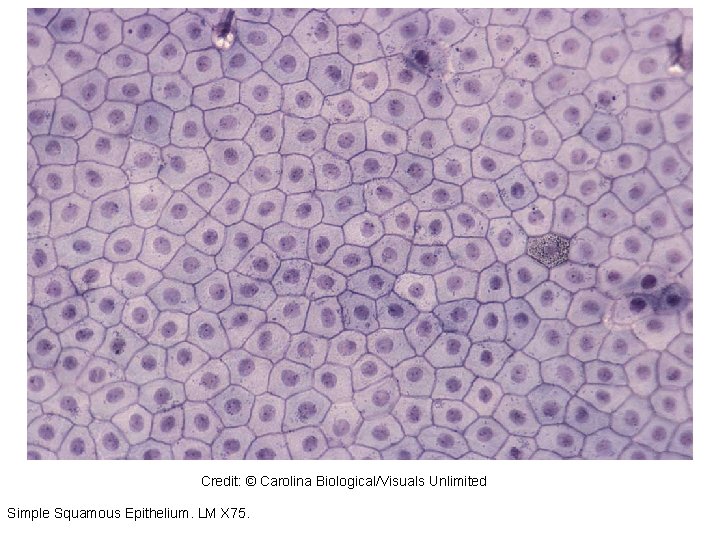 310887 Credit: © Carolina Biological/Visuals Unlimited Simple Squamous Epithelium. LM X 75. 310887 Credit: © Carolina Biological/Visuals Unlimited Simple Squamous Epithelium. LM X 75.
