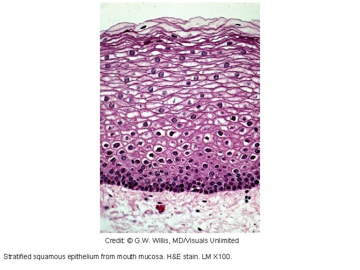 301193 Credit: © G. W. Willis, MD/Visuals Unlimited Stratified squamous epithelium from mouth mucosa. 301193 Credit: © G. W. Willis, MD/Visuals Unlimited Stratified squamous epithelium from mouth mucosa.