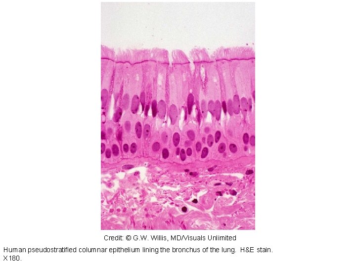 164740 Credit: © G. W. Willis, MD/Visuals Unlimited Human pseudostratified columnar epithelium lining the 164740 Credit: © G. W. Willis, MD/Visuals Unlimited Human pseudostratified columnar epithelium lining the