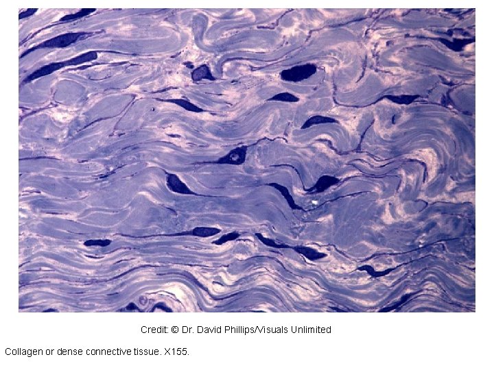 98964 Credit: © Dr. David Phillips/Visuals Unlimited Collagen or dense connective tissue. X 155. 98964 Credit: © Dr. David Phillips/Visuals Unlimited Collagen or dense connective tissue. X 155.