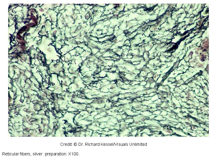 98990 Credit: © Dr. Richard Kessel/Visuals Unlimited Reticular fibers, silver preparation. X 100. 98990 Credit: © Dr. Richard Kessel/Visuals Unlimited Reticular fibers, silver preparation. X 100.