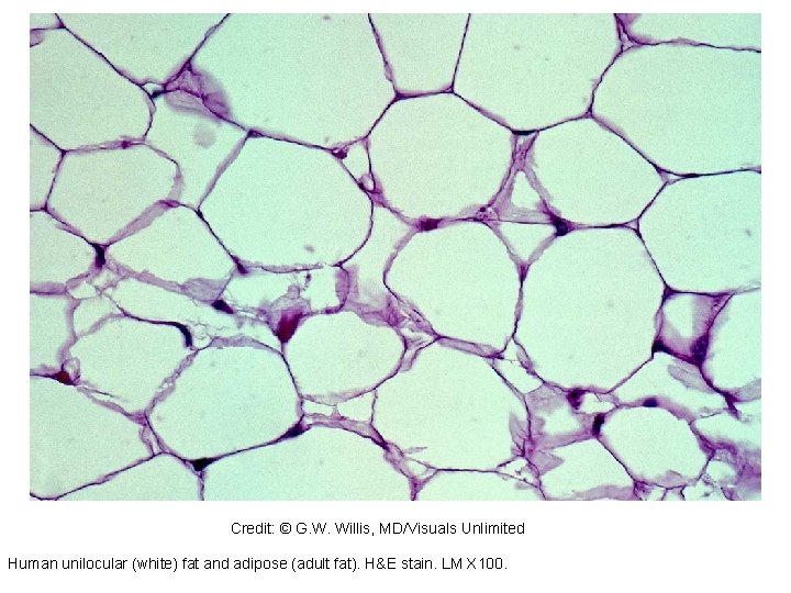 164732 Credit: © G. W. Willis, MD/Visuals Unlimited Human unilocular (white) fat and adipose 164732 Credit: © G. W. Willis, MD/Visuals Unlimited Human unilocular (white) fat and adipose