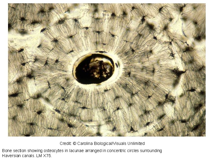 319245 Credit: © Carolina Biological/Visuals Unlimited Bone section showing osteocytes in lacunae arranged in 319245 Credit: © Carolina Biological/Visuals Unlimited Bone section showing osteocytes in lacunae arranged in