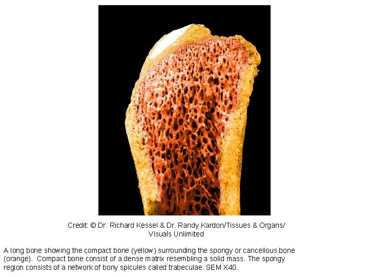 228388 Credit: © Dr. Richard Kessel & Dr. Randy Kardon/Tissues & Organs/ Visuals Unlimited 228388 Credit: © Dr. Richard Kessel & Dr. Randy Kardon/Tissues & Organs/ Visuals Unlimited