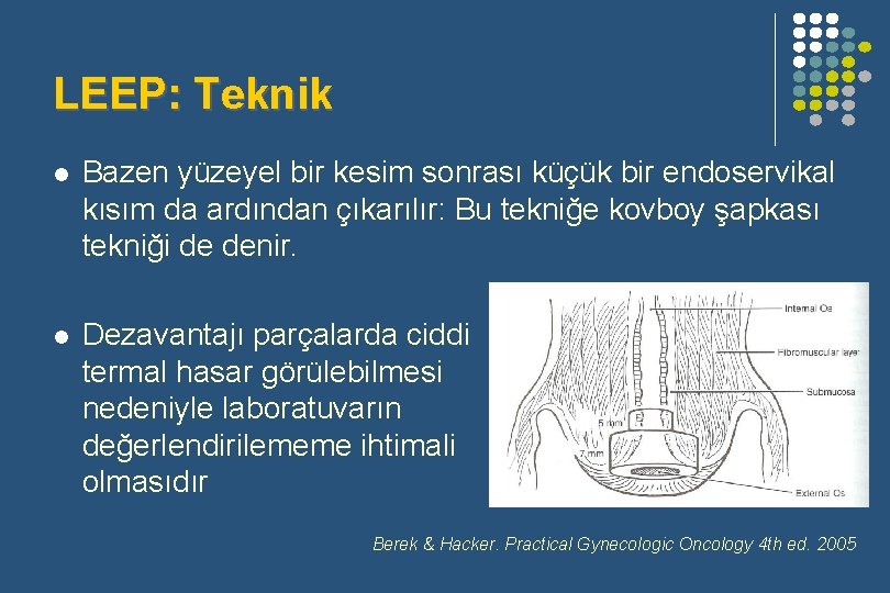 LEEP: Teknik l Bazen yüzeyel bir kesim sonrası küçük bir endoservikal kısım da ardından