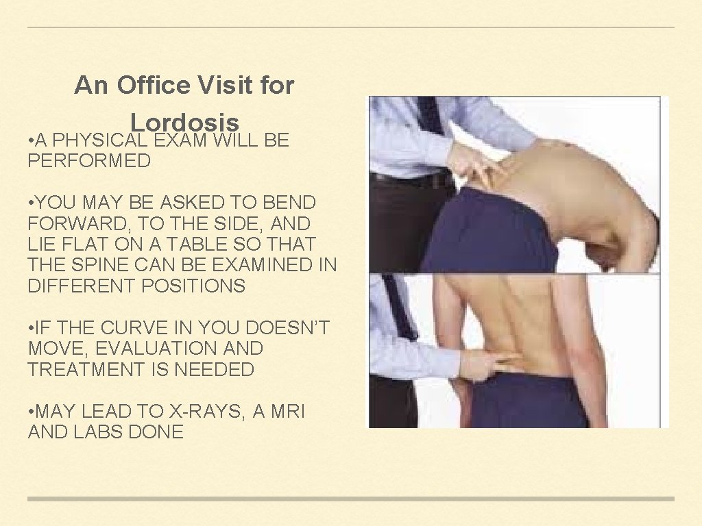 An Office Visit for Lordosis • A PHYSICAL EXAM WILL BE PERFORMED • YOU