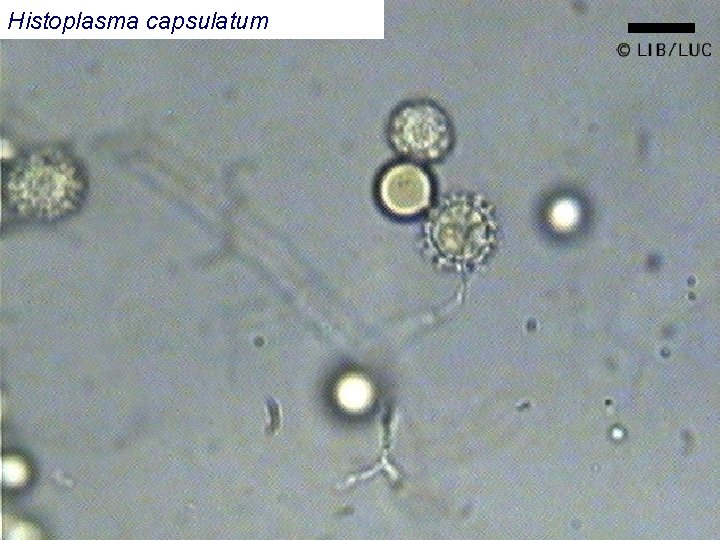 Histoplasma capsulatum 