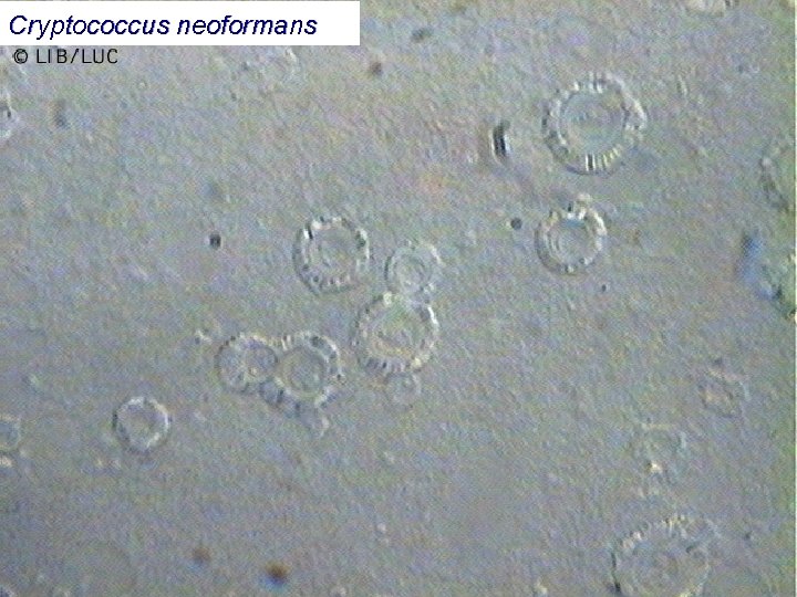 Cryptococcus neoformans 