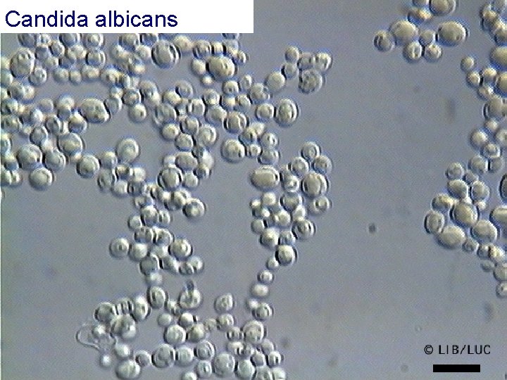 Candida albicans 