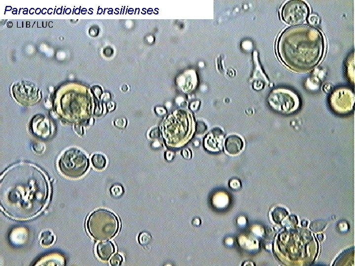 Paracoccidioides brasilienses 