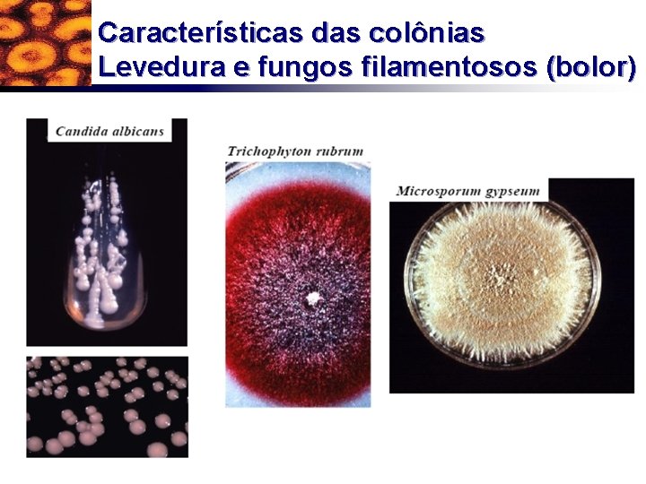 Características das colônias Levedura e fungos filamentosos (bolor) 