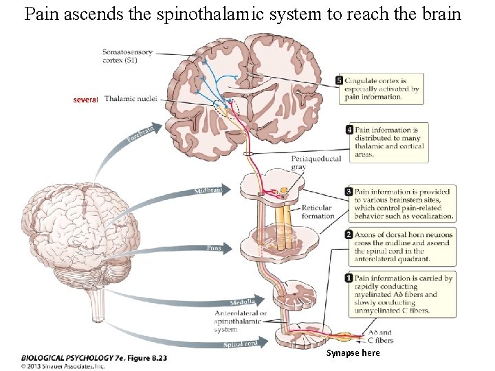 Pain ascends the spinothalamic system to reach the brain several Synapse here 