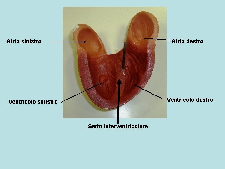 Atrio sinistro Atrio destro Ventricolo sinistro Setto interventricolare 