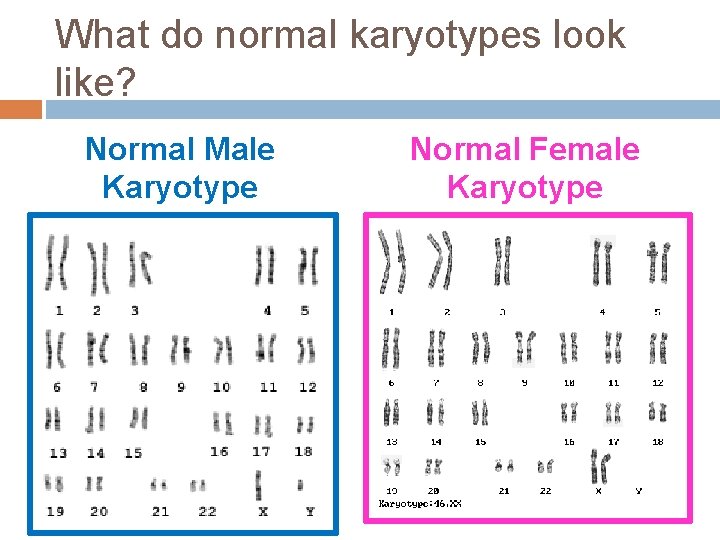 What do normal karyotypes look like? Normal Male Karyotype Normal Female Karyotype 