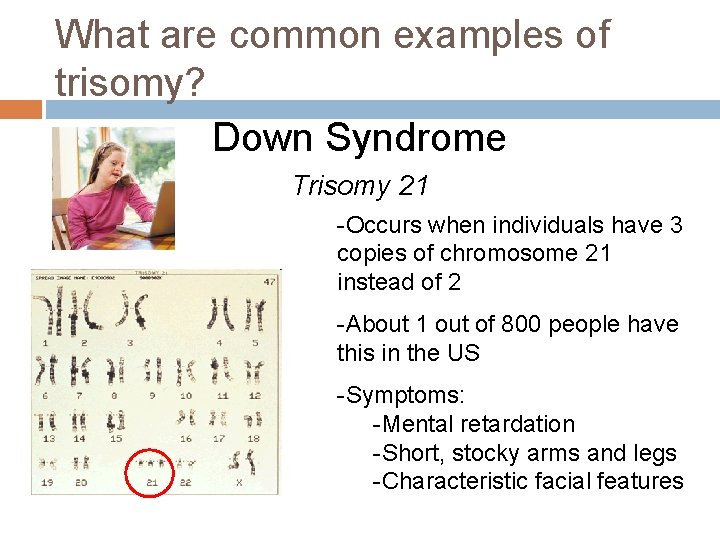 What are common examples of trisomy? Down Syndrome Trisomy 21 -Occurs when individuals have