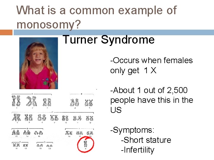 What is a common example of monosomy? Turner Syndrome -Occurs when females only get
