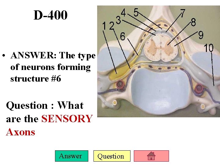 D-400 • ANSWER: The type of neurons forming structure #6 Question : What are
