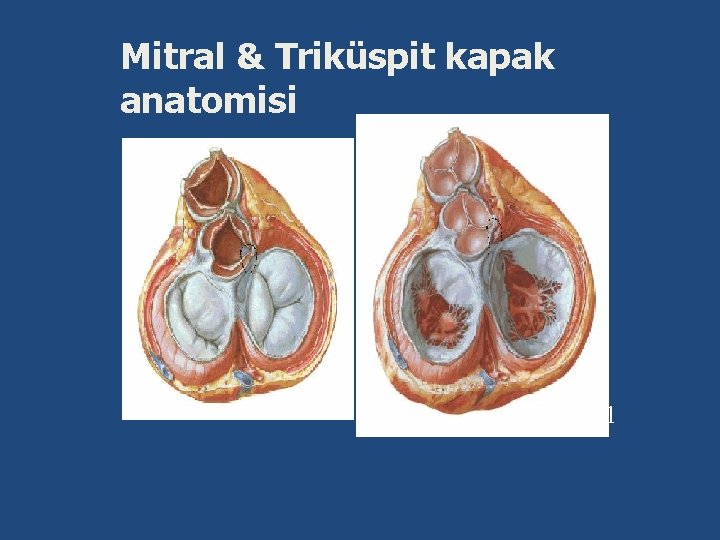 Mitral & Triküspit kapak anatomisi Sistol Diyastol 